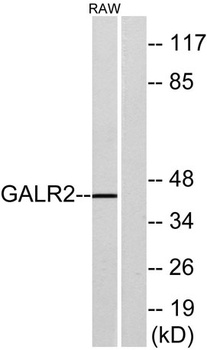 GALR2 rabbit pAb Antibody