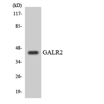 GALR2 rabbit pAb Antibody