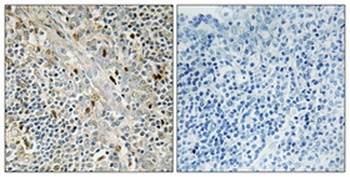 Cyclin D3 rabbit pAb Antibody