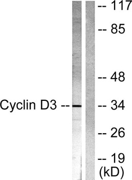 Cyclin D3 rabbit pAb Antibody