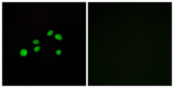 COL23A1 rabbit pAb Antibody