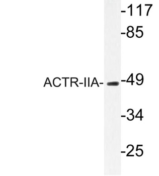 ACTR-IIA rabbit pAb Antibody