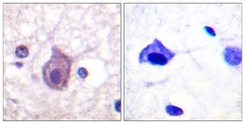 CD4 (phospho Ser433) rabbit pAb Antibody