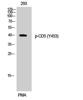 CD5 (phospho Tyr453) rabbit pAb Antibody