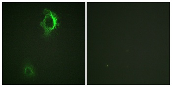CD5 (phospho Tyr453) rabbit pAb Antibody