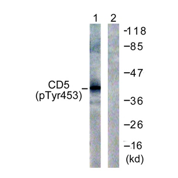 CD5 (phospho Tyr453) rabbit pAb Antibody