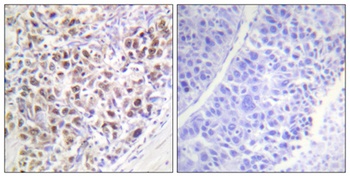 ARK-2 (phospho Thr232) rabbit pAb Antibody