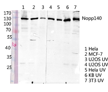 Nopp140 rabbit pAb Antibody