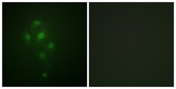 MSK1 (phospho Thr581) rabbit pAb Antibody