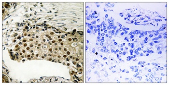 MSK1 (phospho Ser212) rabbit pAb Antibody