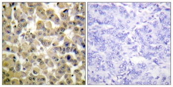 MSK1 (phospho Ser360) rabbit pAb Antibody
