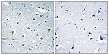 TRIP15 rabbit pAb Antibody