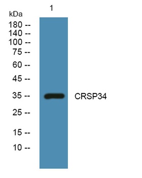 CRSP34 rabbit pAb Antibody