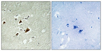 JIP-1 (phospho Thr103) rabbit pAb Antibody