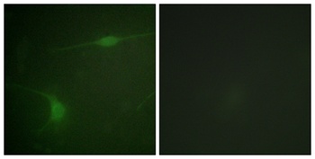 JIP-1 (phospho Thr103) rabbit pAb Antibody