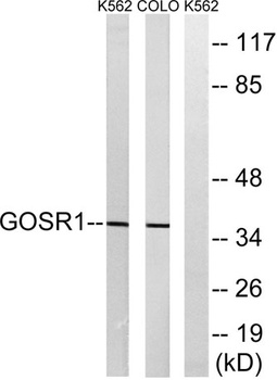 GS28 rabbit pAb Antibody