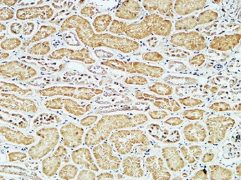 CD79a rabbit pAb Antibody