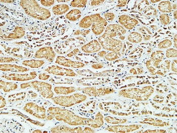 CD79a rabbit pAb Antibody