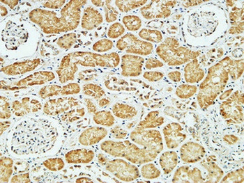 CD79a rabbit pAb Antibody