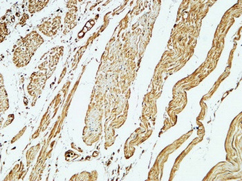 CD79a rabbit pAb Antibody
