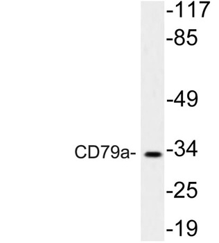 CD79a rabbit pAb Antibody