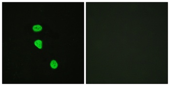 TBC1D4 (phospho Thr642) rabbit pAb Antibody