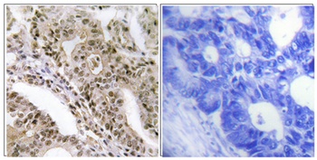 TBC1D4 (phospho Thr642) rabbit pAb Antibody