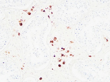 Karyopherin α2 rabbit pAb Antibody