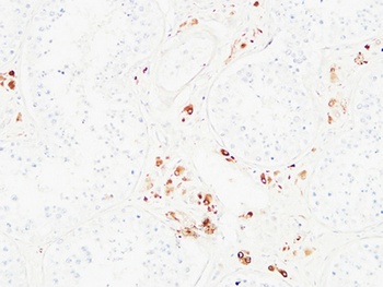 Karyopherin α2 rabbit pAb Antibody