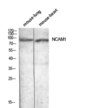 CD56 rabbit pAb Antibody