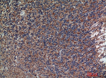 CD56 rabbit pAb Antibody