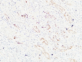 K-Ras rabbit pAb Antibody