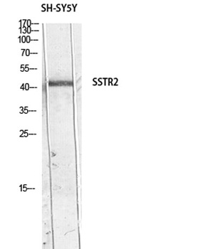 SSTR2 rabbit pAb Antibody
