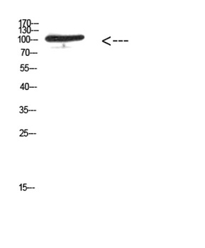 MER/TYRO3 (Phospho-Tyr753/Tyr685) rabbit pAb Antibody