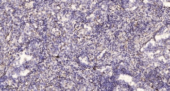 MER/TYRO3 (Phospho-Tyr753/Tyr685) rabbit pAb Antibody