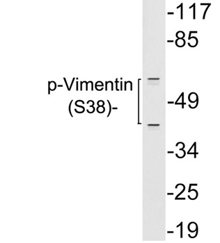 Vimentin (Phospho-Tyr38) rabbit pAb Antibody
