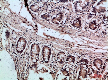 Villin rabbit pAb Antibody