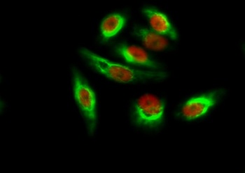 Amyloid-β rabbit pAb Antibody