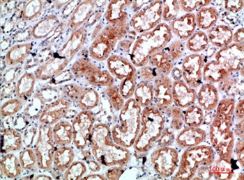 Perforin 1 rabbit pAb Antibody