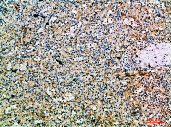 Perforin 1 rabbit pAb Antibody