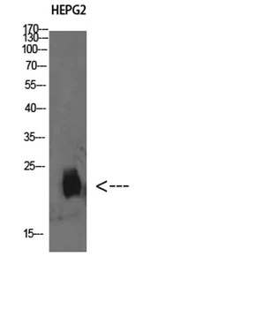 Plasminogen receptor rabbit pAb Antibody