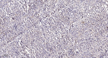 Plasminogen receptor rabbit pAb Antibody