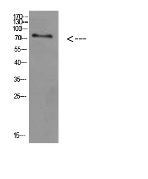 ACSS1 rabbit pAb Antibody