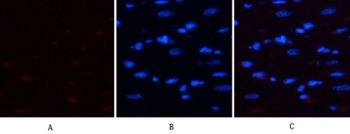 E2F-1 rabbit pAb Antibody