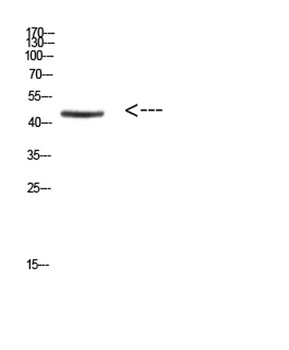 Ini1 rabbit pAb Antibody