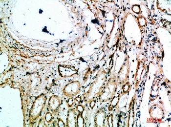 MIB1 rabbit pAb Antibody