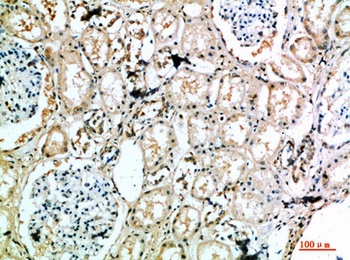 MIB1 rabbit pAb Antibody