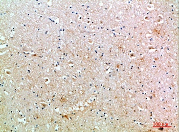 MIB1 rabbit pAb Antibody