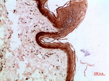 Cytokeratin 14/17 rabbit pAb Antibody