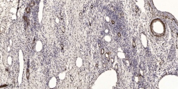 PENK rabbit pAb Antibody